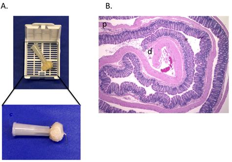 Murine Colitis Modeling Using Dextran Sulfate Sodium Dss Pmc