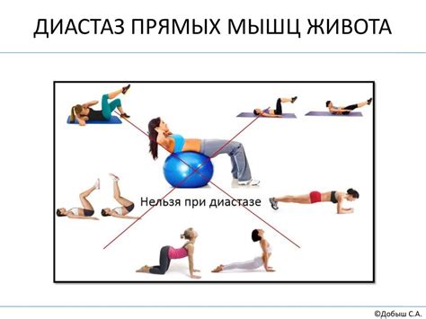 Сестринская помощь при грыжах живота - online presentation