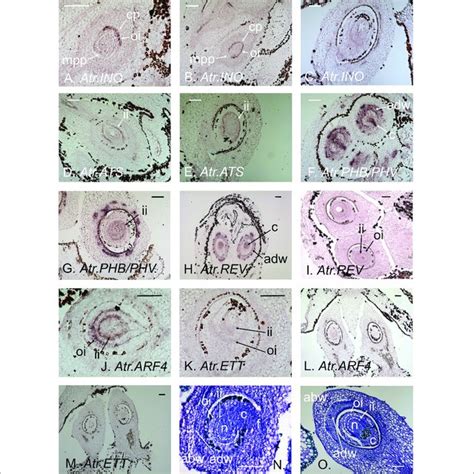 Variation in stipule morphology and arrangement of stipule in respect ...