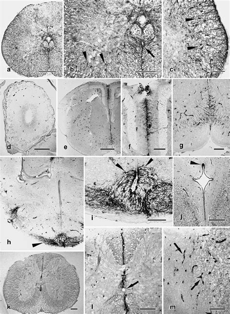 GFAP Immunostaining In The Spinal Cord A C And Vimentin