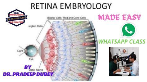 Embryology Of Retina Choroidal Coloboma Ophthal Pg Exam Preparation Pg Teaching Program