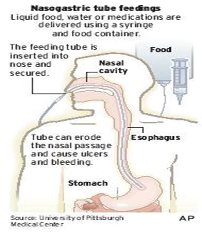 240 Enteral Nutrition Flashcards Quizlet