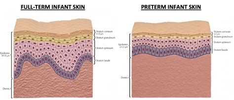 Diapering For Healthy Skin And Development Synova