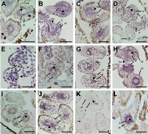 Frontiers Ovule Gene Expression Analysis In Sexual And Aposporous