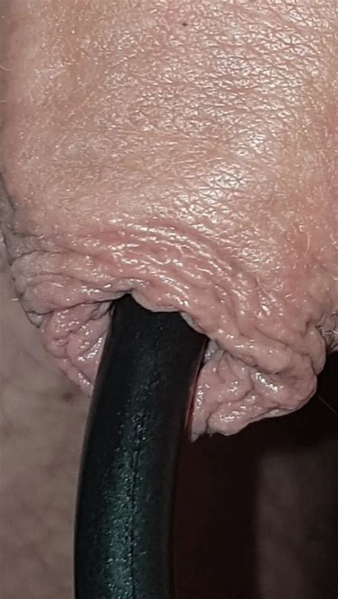 Urethral Insertion 80 Nude Pics 2 XHamster
