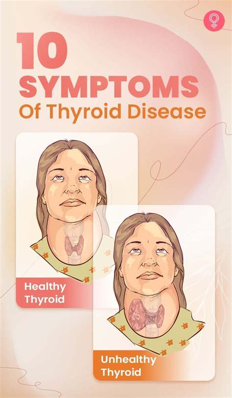 16 Signs Of Thyroid Problems In Women You Should Know Plus How To Improve Your Thyroid Health