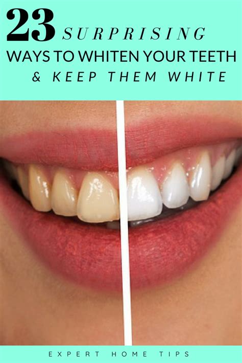 23 Surprising Ways To Whiten Your Teeth… And Keep Them White Expert