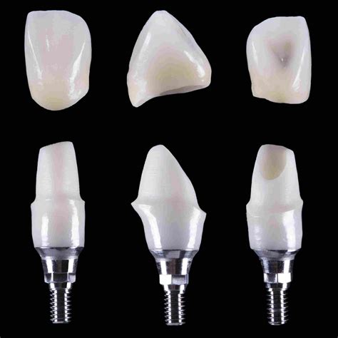 Zirconium Crown