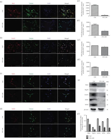 Bmi1 Foxo1 Sod1 And Sod2 Expressions In Sgns After Ptc 209