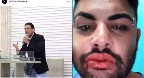 Pastor Evang Lico Que Pregava Amor De Deus Espanca O Sobrinho Gay Os Cabe As Da Not Cia