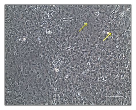 The Morphology Of Inductions Of Adipose Derived Stem Cell I Adsc