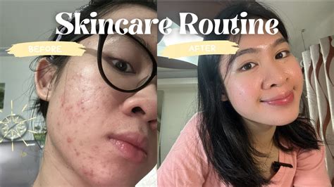 Skincare Routine Các bí quyết giúp mình chăm sóc cải thiện DA MỤN