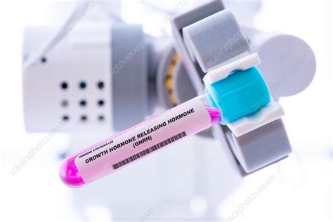 Growth hormone releasing hormone, conceptual image - Stock Image - F036/7344 - Science Photo Library