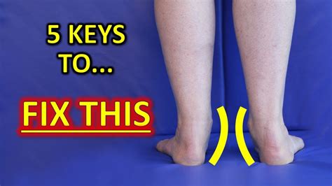 The 5 Keys To Improve Flat Feet Fallen Arches And Foot Overpronation