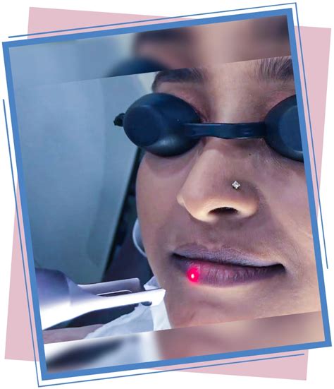 switched  yag laser dr sajjas clinic  tirupati
