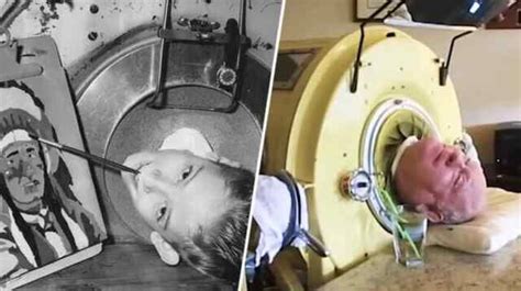 R I P Paul Alexander Man In An Iron Lung Since Age 6 Dies At 78