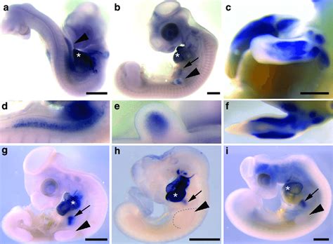 In situ hybridization analysis of Nkx2.5 expression in avian embryos ... 