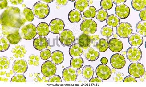 Freshwater Microalgae Blooming Under Microscope Species Stock Photo ...