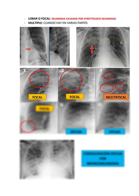 Solution Resumen Patrones Radiologicos Studypool