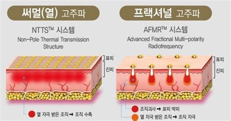 닥터 칼럼 닥터칼럼 차앤박피부과