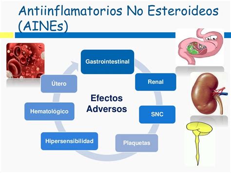 Fármacos Antiinflamatorios no esteroideos AINE