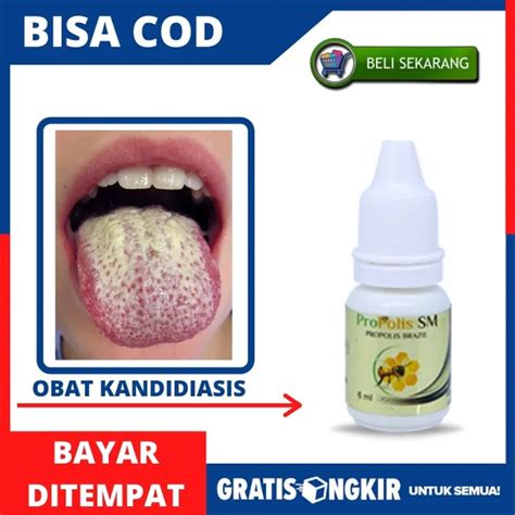 Obat Penyakit Kandidiasis Aman Bpom Halal Infeksi Jamur Di Lidah Candidiasis Mulut Untuk