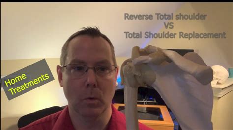 Physical Therapy Reverse Total Shoulder Replacement Vs Total Shoulder Replacement Youtube