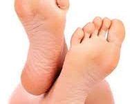 Las Mejores 67 Ideas De Pies Sanos Pies Sanos Podologia Clinica