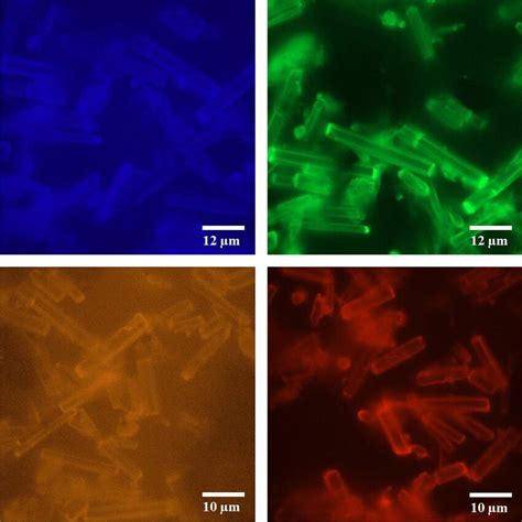 Epifluorescence Micrographs Of Znpc Cnc Tmr System Using Nm