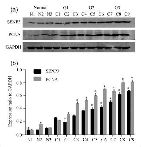 Expression Changes Of Senp In Normal Ovary And Eoc Tissues A