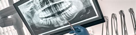 South Pasadena Dental Group A Root Canal In South Pasadena Does Not