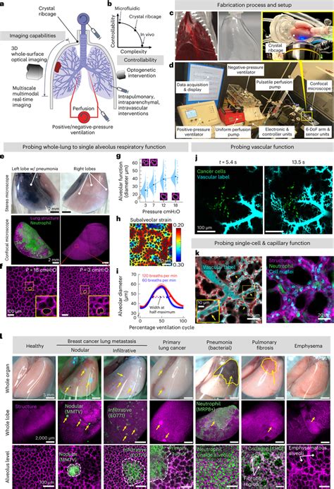 Development Capabilities And Application Of The Crystal Ribcage In