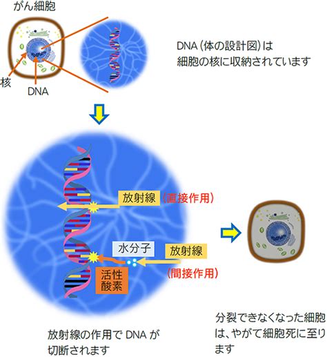 Survivorshipjp がんと向きあって ｜がん放射線治療の概要｜がんの放射線治療について｜放射線治療の目的