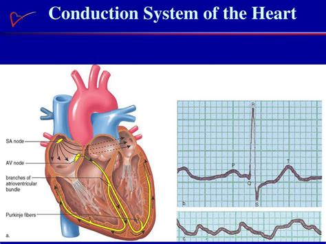 Ppt Cardiovascular Disease Overview Powerpoint Presentation Free