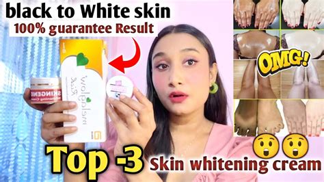 Top 3 Skin Whitening Cream Best Skin Whitening Cream Skingenie Cream