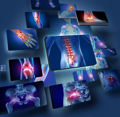 Biological therapies in inflammatory arthritis | OnMedica