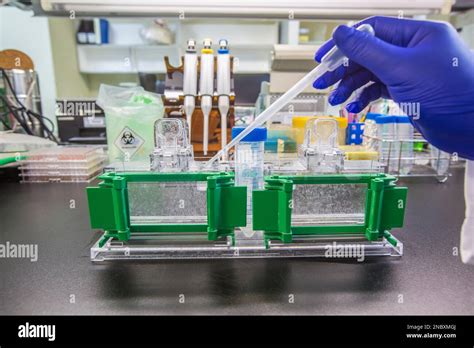 Analyse Western blot utilisation comme analyse de protéines pour la