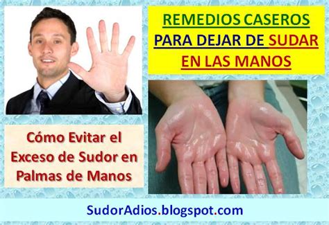 Como Evitar El Sudor En Las Manos Hiperhidrosis Palmar Tratamiento