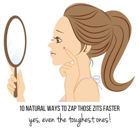 10 DIY ways to zap zits faster (even the toughest ones!)