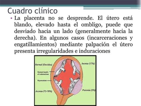 Hemorragia Posparto Y Retenci N Placentaria Ppt