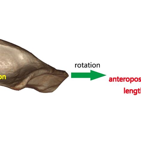 adjustment   axial view   axial view  shoulder joint