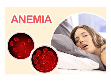 Causas De La Anemia El Men