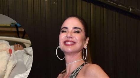 Luciana Gimenez exibe foto e vídeo de perna quebrada depois de acidente