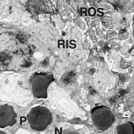 Light Treated Rcs Rat At P Peripheral Retina Normal Morphology Of