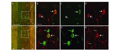 | Examples of single-and double-labeled interneurons. (A,E ...