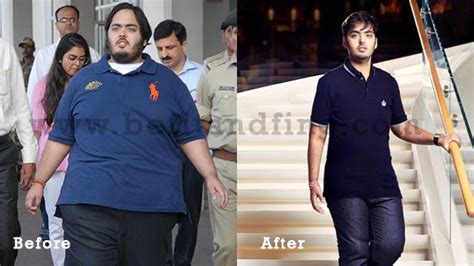 Anant Ambani Weight Loss : Amazing Story of Losing 108 kgs in 18 Months