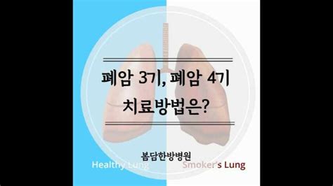 폐암 3기 폐암 4기 치료방법에 대해 알아보자 네이버 블로그