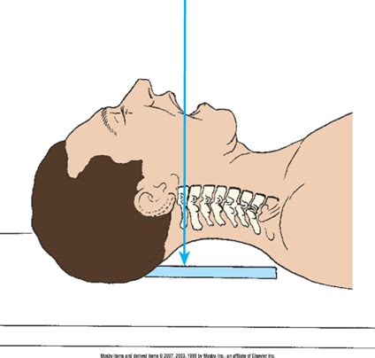 Test 1 Cervical Spine Flashcards Quizlet