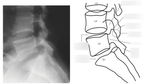 Lumbar Spine Anatomy L5 S1