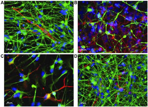 Rescue Of Aberrant Neural Differentiation Of FXS IPSC Derived Neuronal